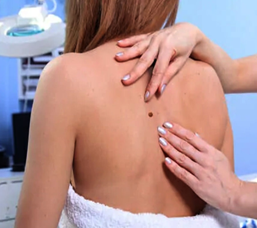 Dermatosurgery: Elite Clinic Dermatosurgery: Elite Clinic