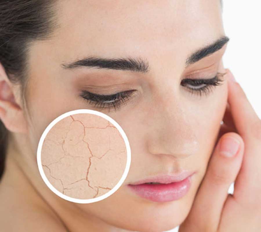 Best Skin treatment in Delhi