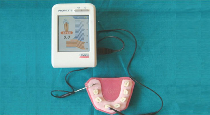 E-Apex at Elite Clinic: Dentist in Rohini, Delhi