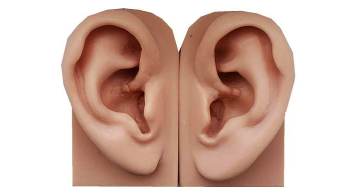 Artificial Ear: Elite Clinic Artificial Ear surgery at Elite Clinic: Best Dermatologist in Rohini, Delhi