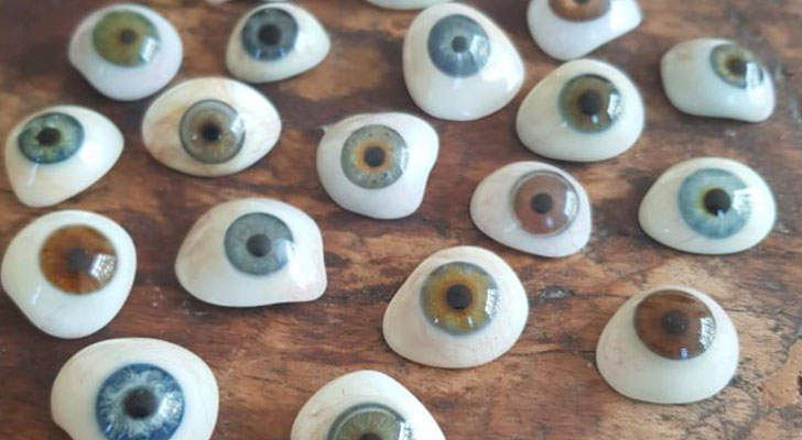 Artificial Eyes: Elite Clinic Artificial Eyes surgery at Elite Clinic: Best Dermatology in Rohini, Delhi