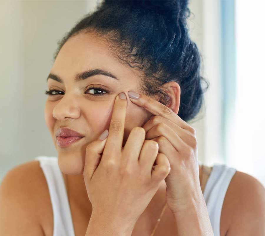Acne treatment at Elite Clinic Best Skin treatment in Delhi