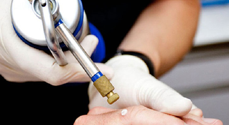 Cryosurgery: Elite Clinic Cryosurgery treatment at Elite Clinic: Best Dermatologist in Rohini, Delhi