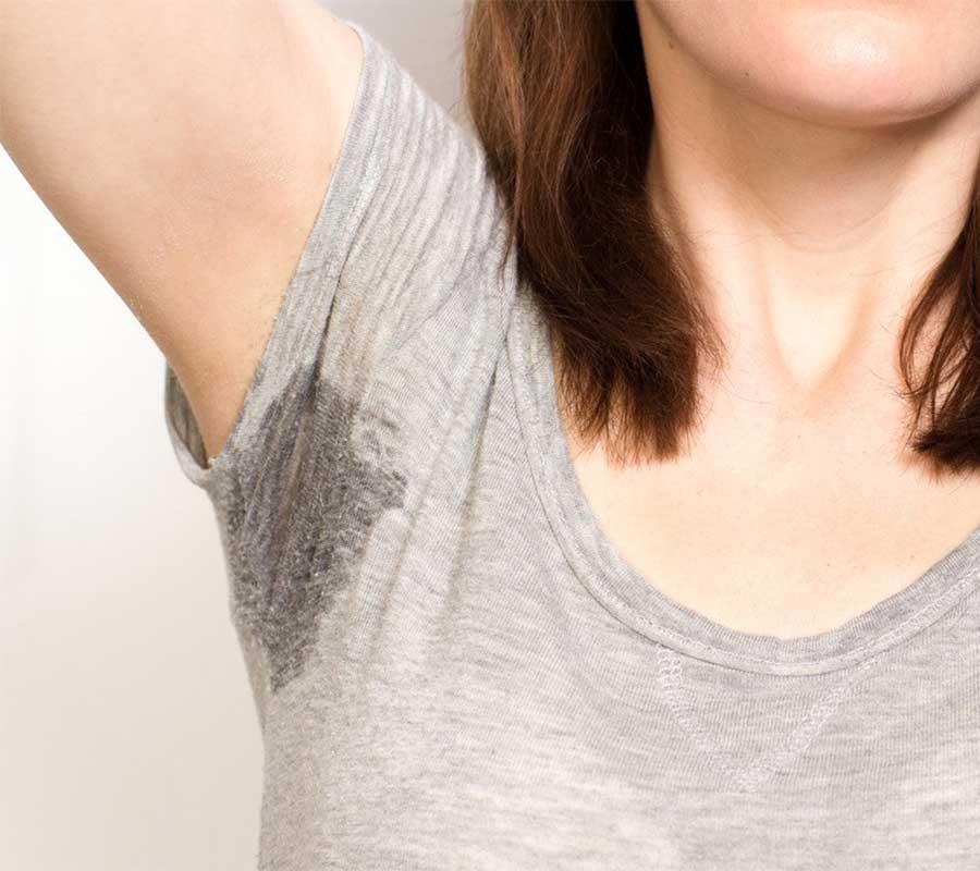 Hyperhidrosis solution at Elite Clinic