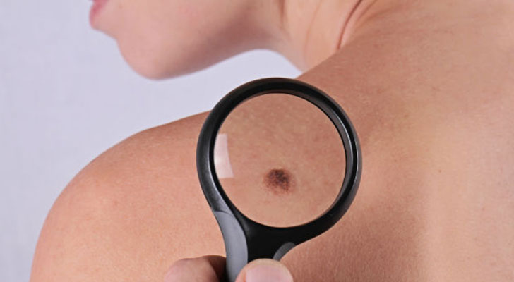 Skin-Biopsy: Elite Clinic Skin-Biopsy treatment at Elite Clinic: Best Dermatologist in Rohini, Delhi