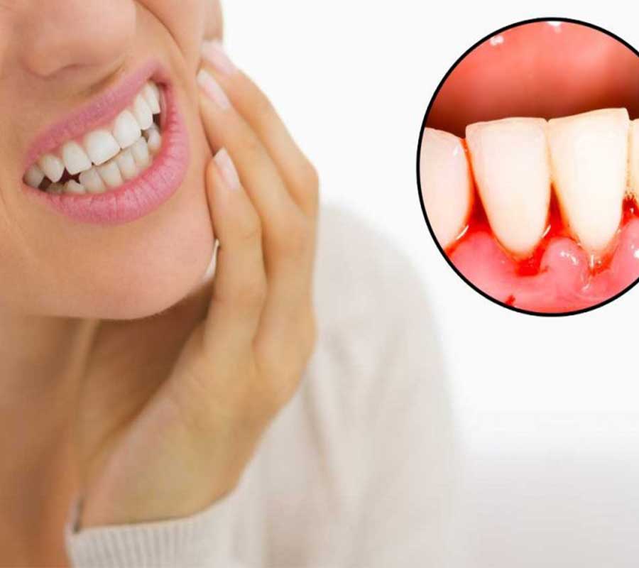 Gum Problems treatment at Elite Clinic: best dentist in delhi | best dentist in rohini
