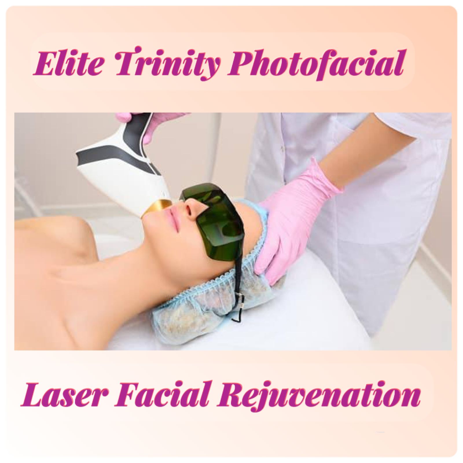 Elite Trinity Photofacial